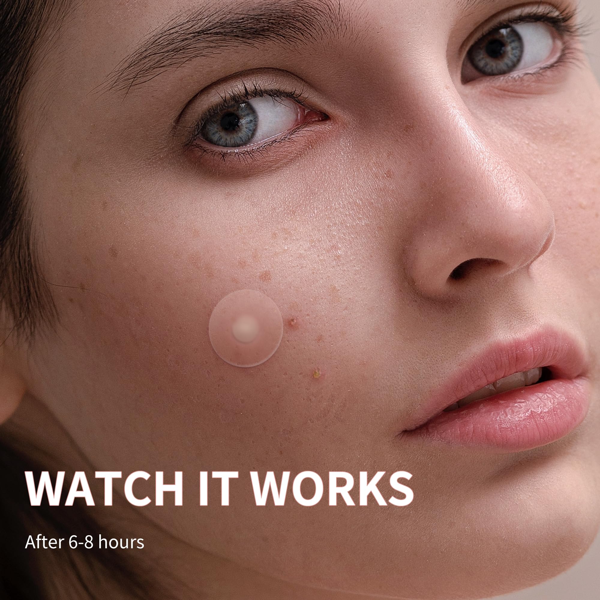 Close up view of the ultra thin transparent hydrocolloid pimple stickers.