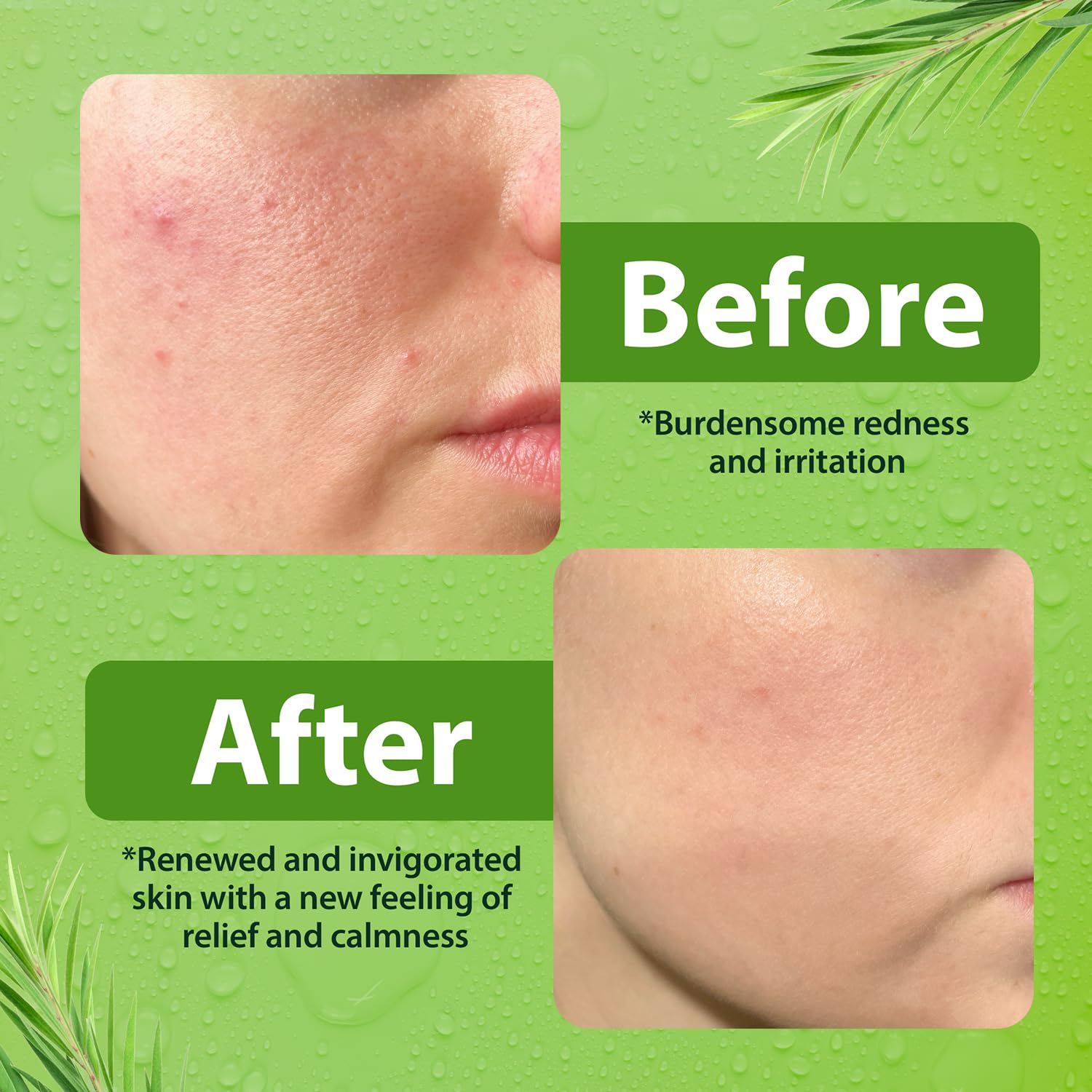 Derma-Nu 8 ounce sensitive skin facial cleanser side view details