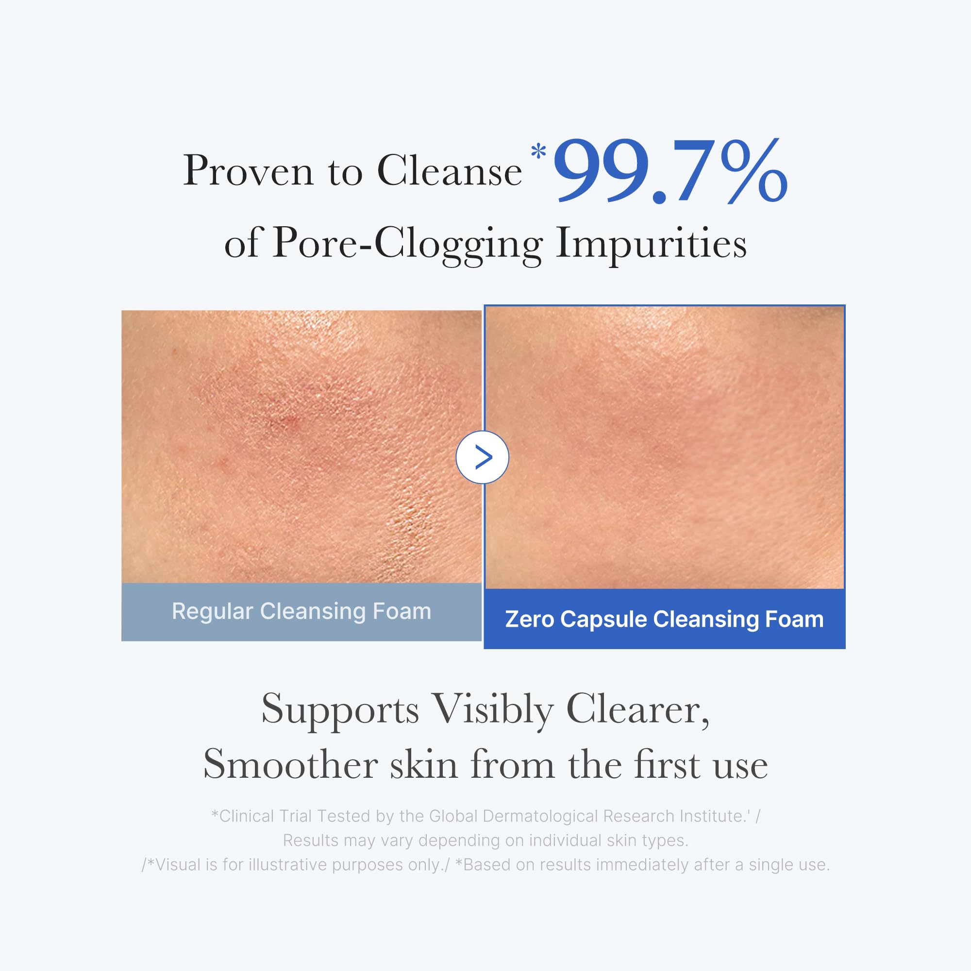 Texture of Medicube Zero Pore SA Clear Capsule Cleansing Foam
