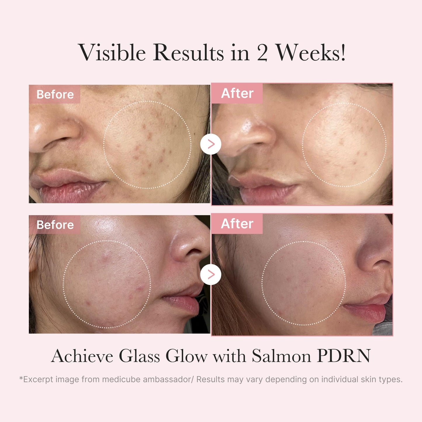 Close up of Medicube Salmon DNA serum bottle