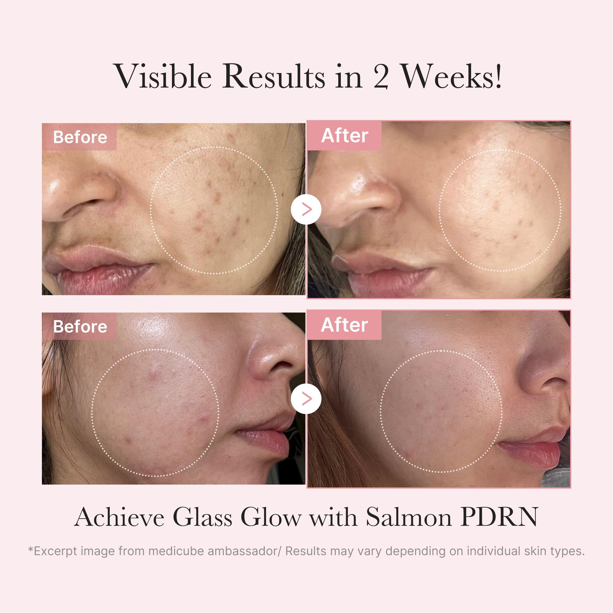 Close up of Medicube Salmon DNA serum bottle