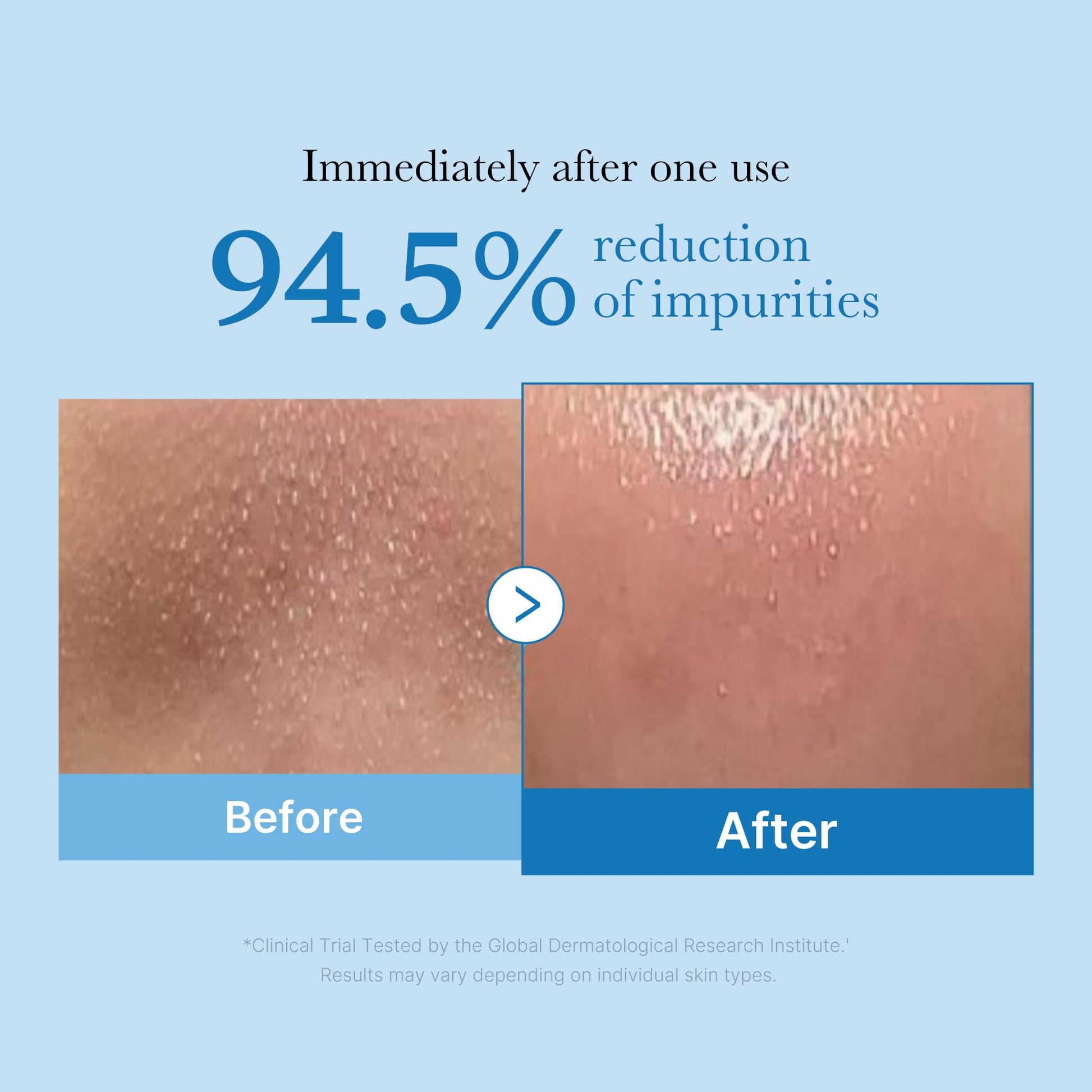 Medicube Zero Pore Blackhead Cleansing Oil packaging details