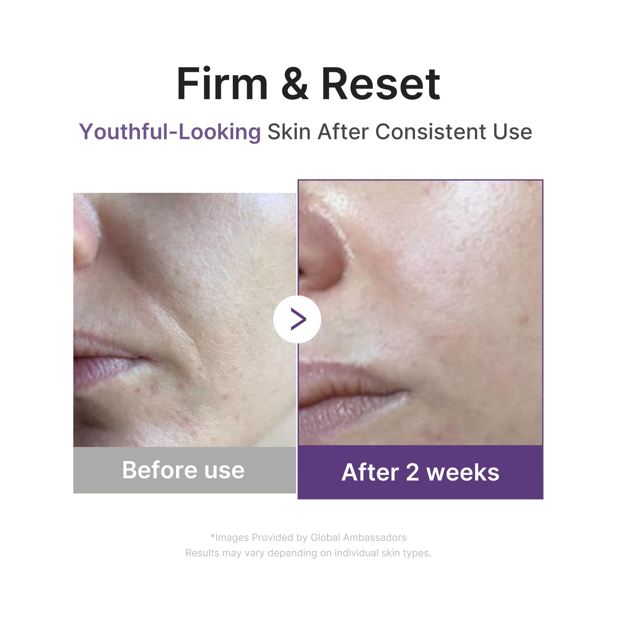 Medicube Retinol Boosting Serum ingredients and benefits label