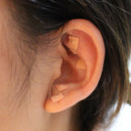 Complete auricular therapy set laid out for home wellness use