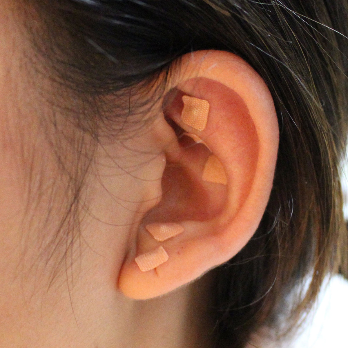Complete auricular therapy set laid out for home wellness use
