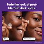 Hero Cosmetics dark spot patch individual pouch packaging