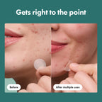 Hero Cosmetics Mighty Patch Micropoint back box labeling details