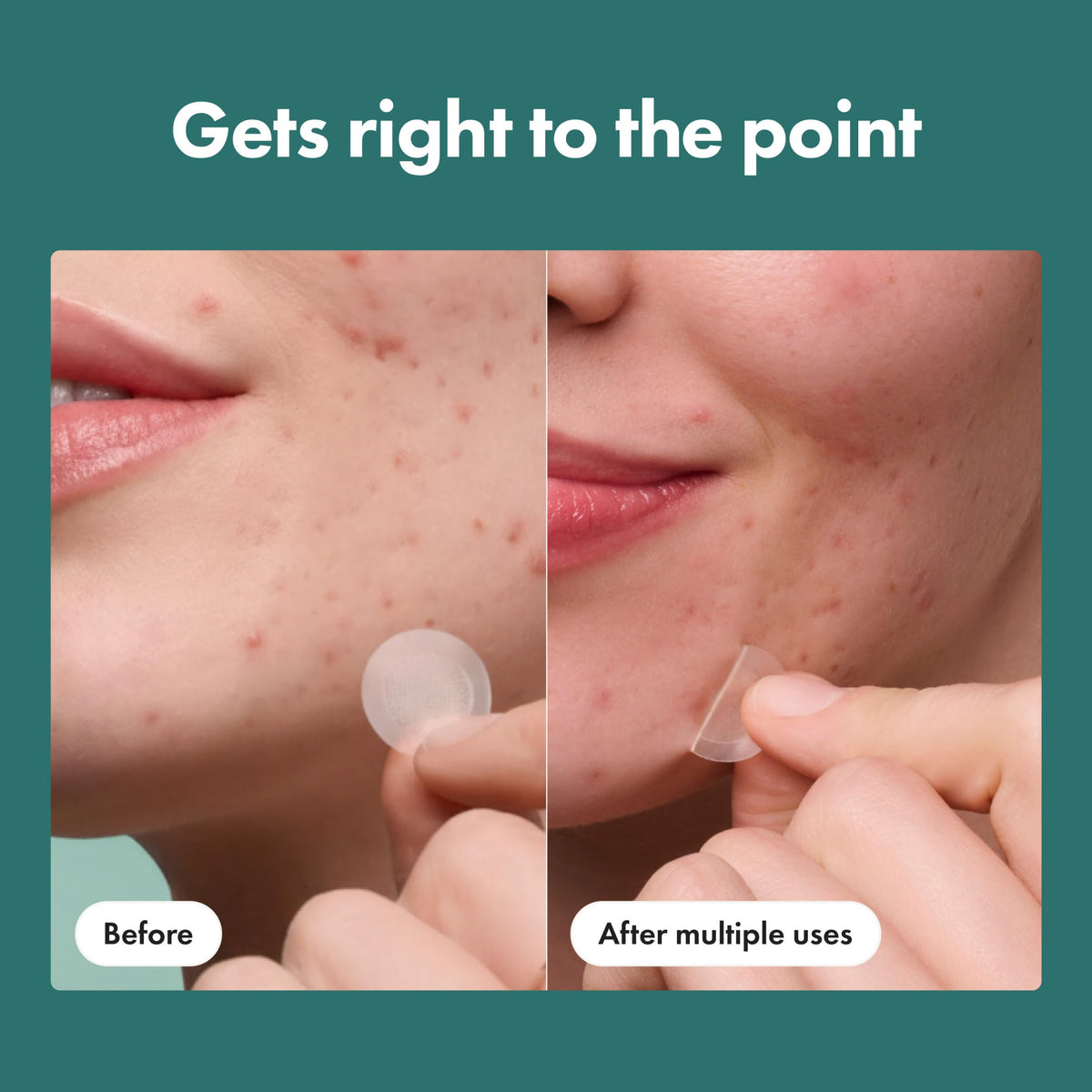 Hero Cosmetics Mighty Patch Micropoint back box labeling details
