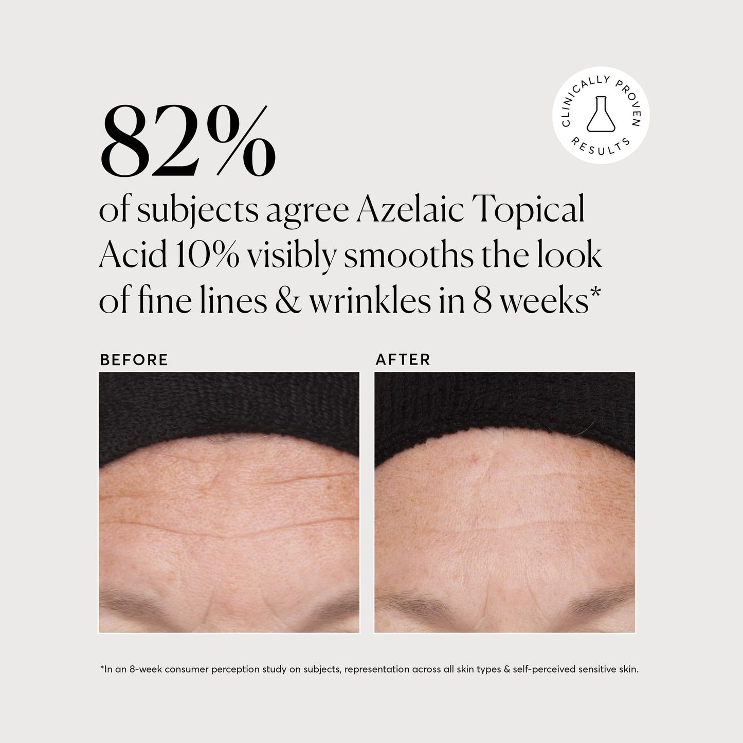 Naturium 1 ounce direct acid treatment for facial redness and congestion
