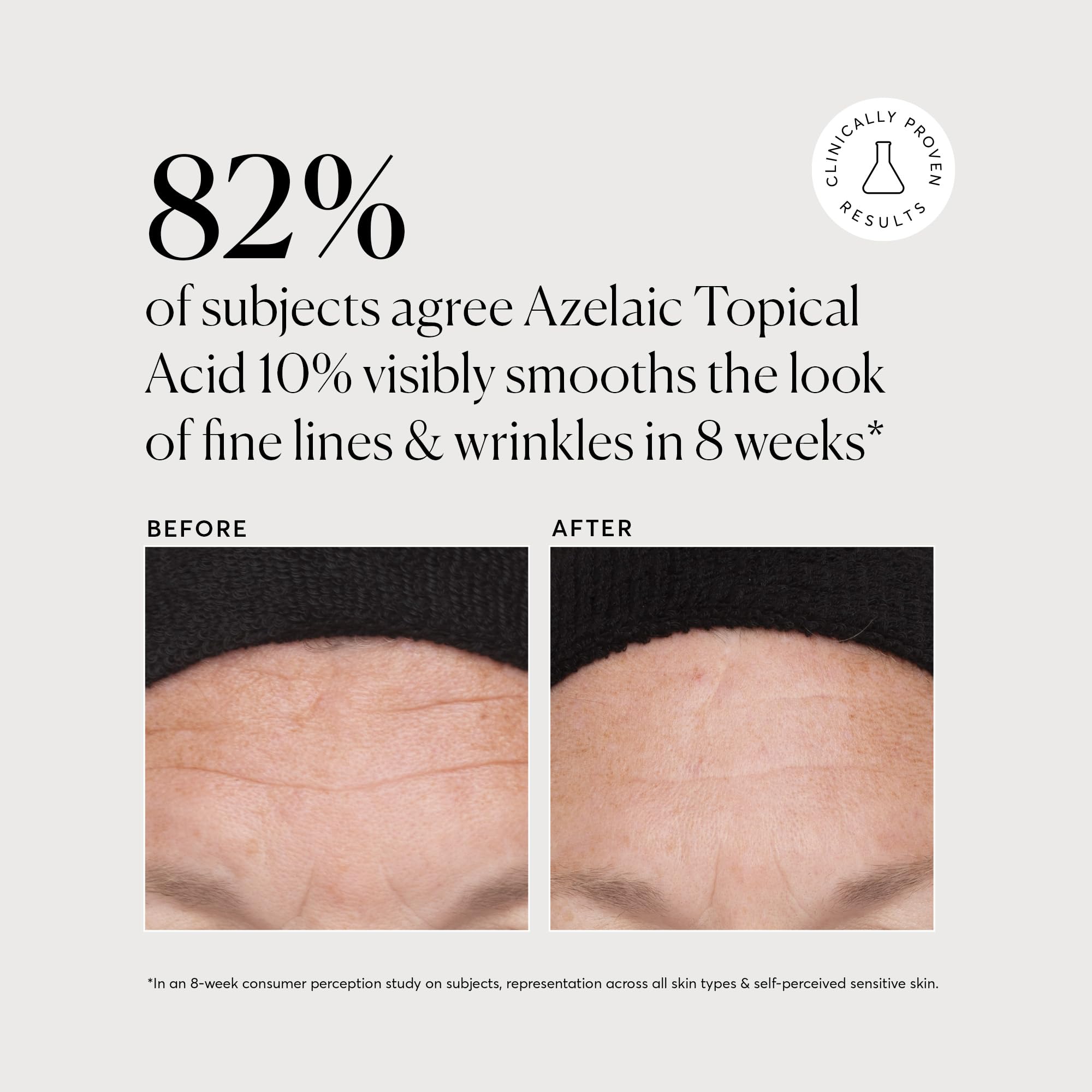 Naturium 1 ounce direct acid treatment for facial redness and congestion