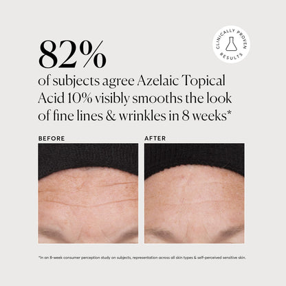Naturium 1 ounce direct acid treatment for facial redness and congestion