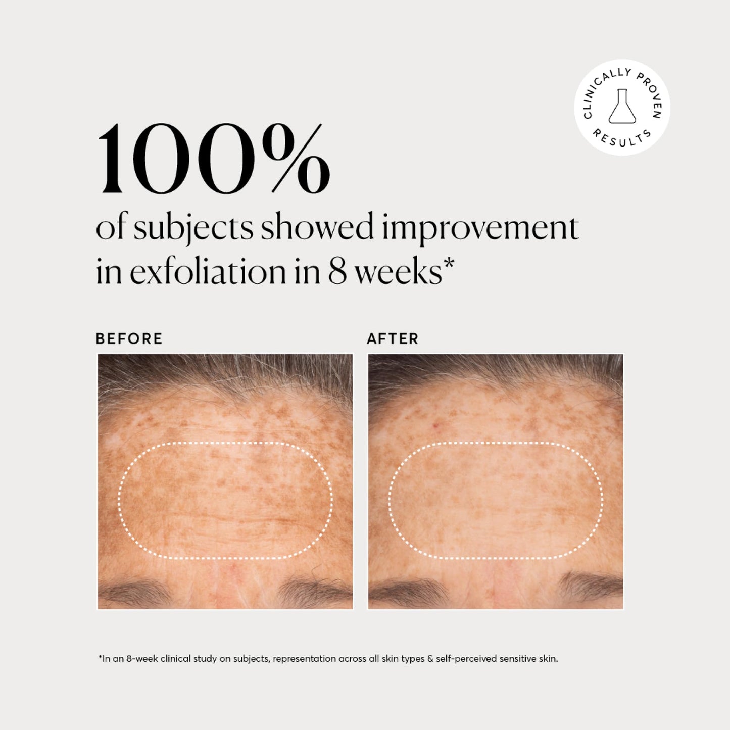 Authentic Naturium USA imported BHA liquid exfoliant for clear skin texture