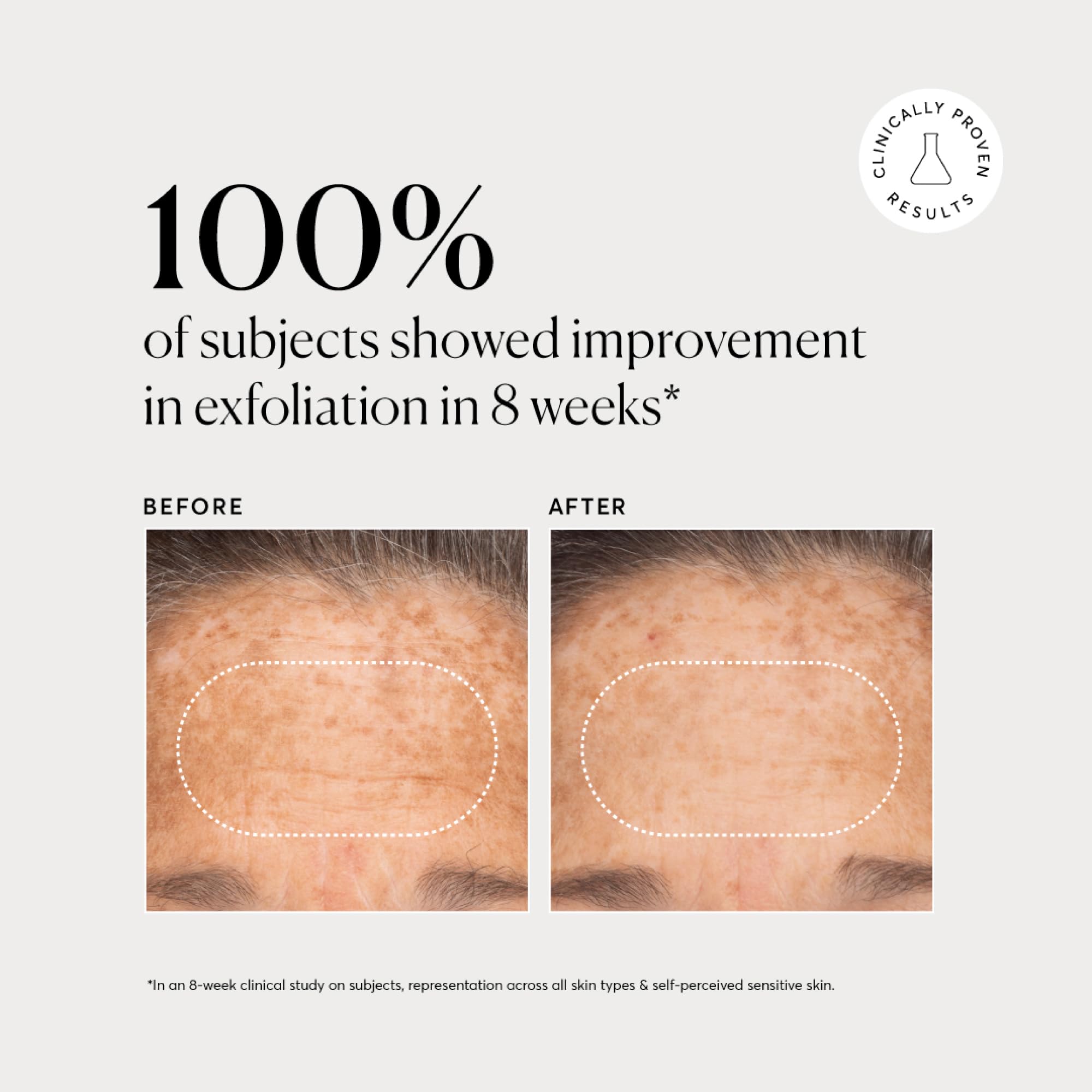 Authentic Naturium USA imported BHA liquid exfoliant for clear skin texture