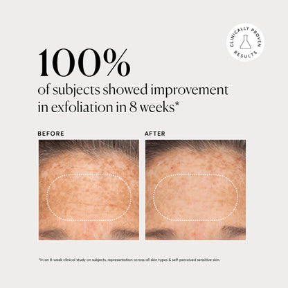 Authentic Naturium USA imported BHA liquid exfoliant for clear skin texture