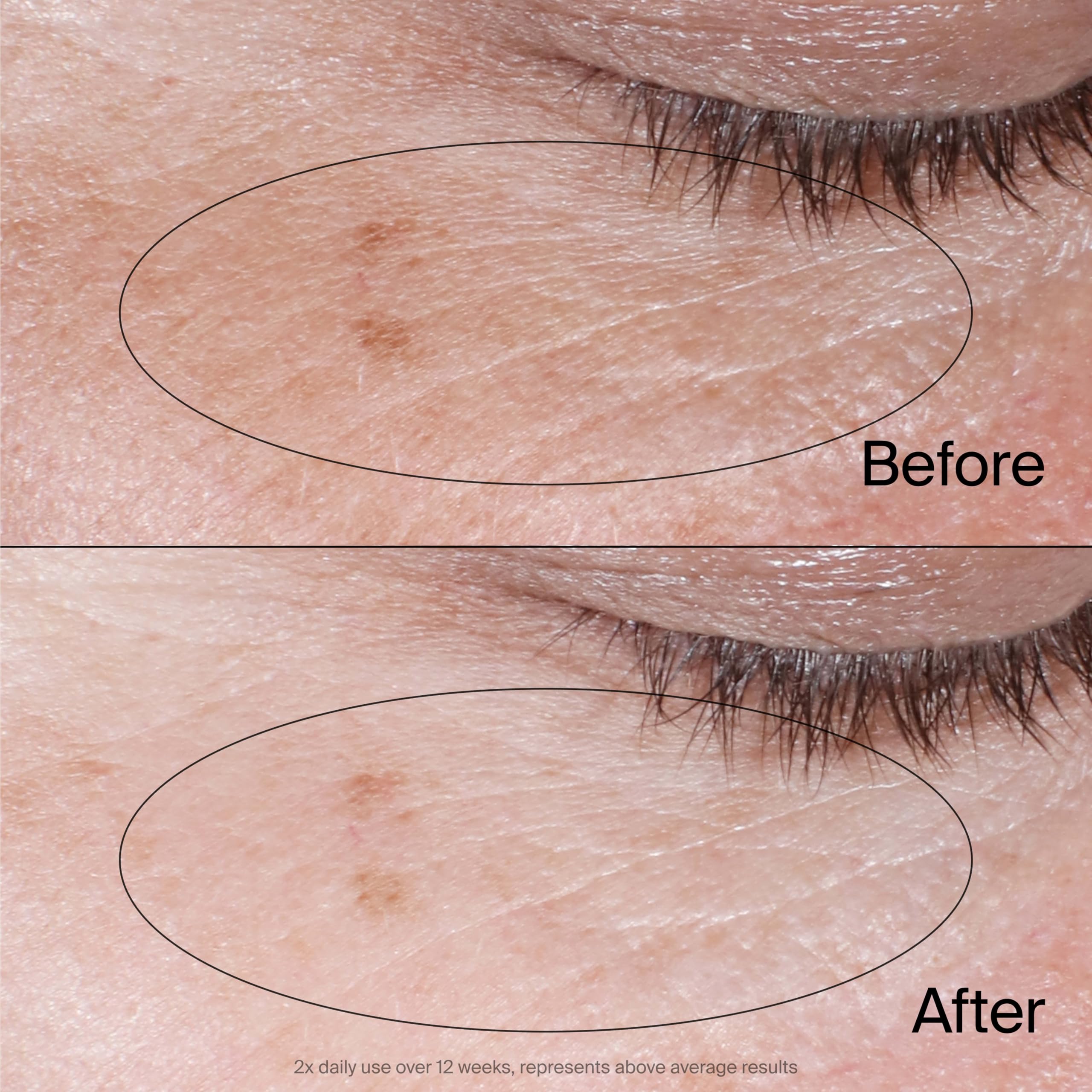 Application of Neutrogena Collagen Bank Eye Gel under eye area