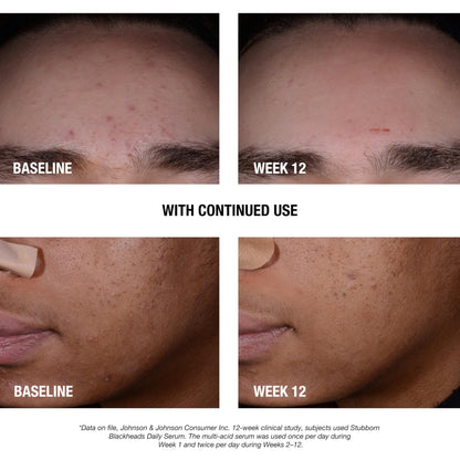 Neutrogena salicylic acid and glycolic acid exfoliating serum clear liquid texture