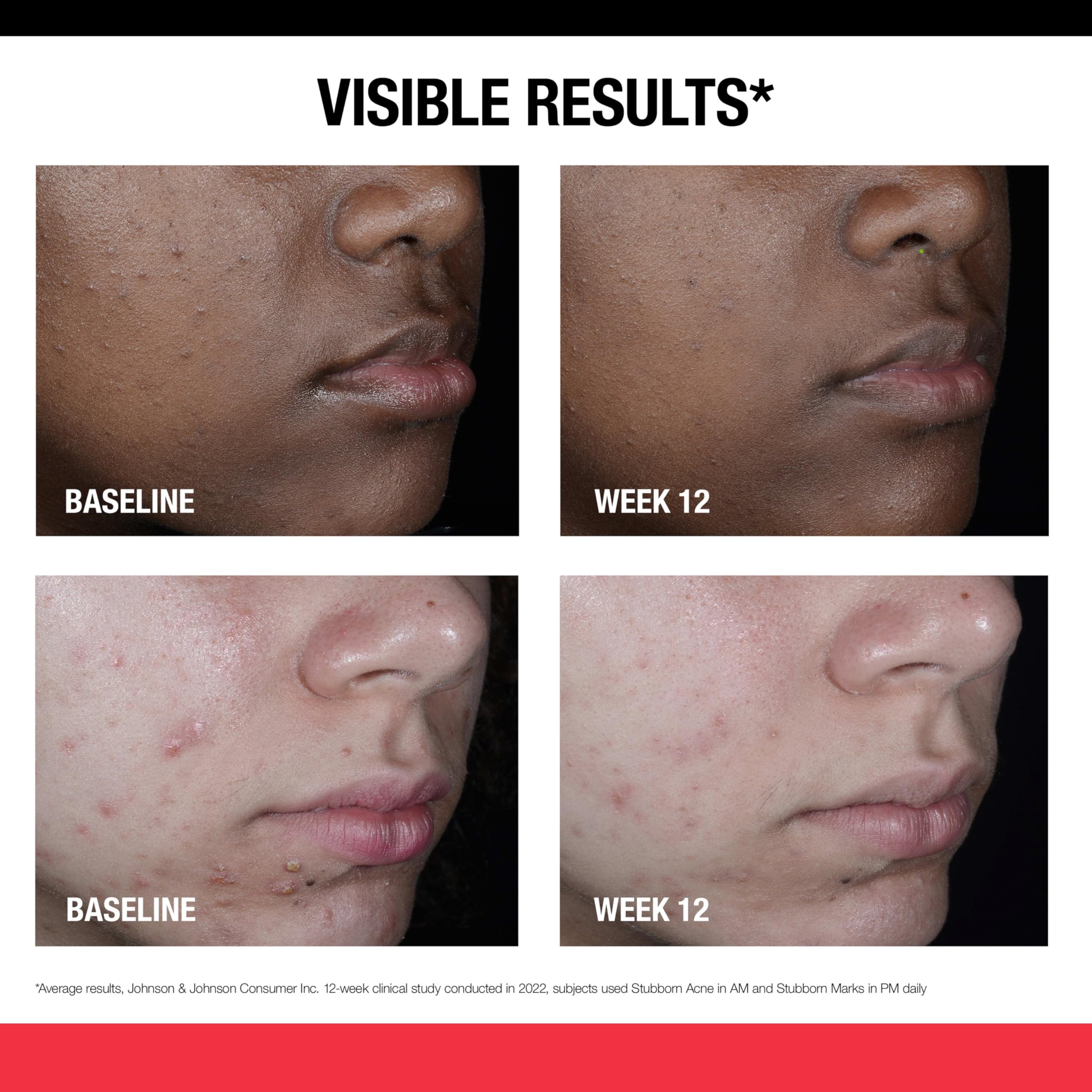 Neutrogena nighttime face exfoliating serum branding