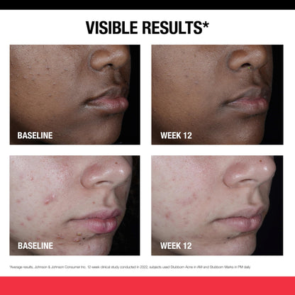Neutrogena nighttime face exfoliating serum branding