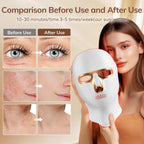 Onluky cordless light therapy mask showing internal LED bead layout