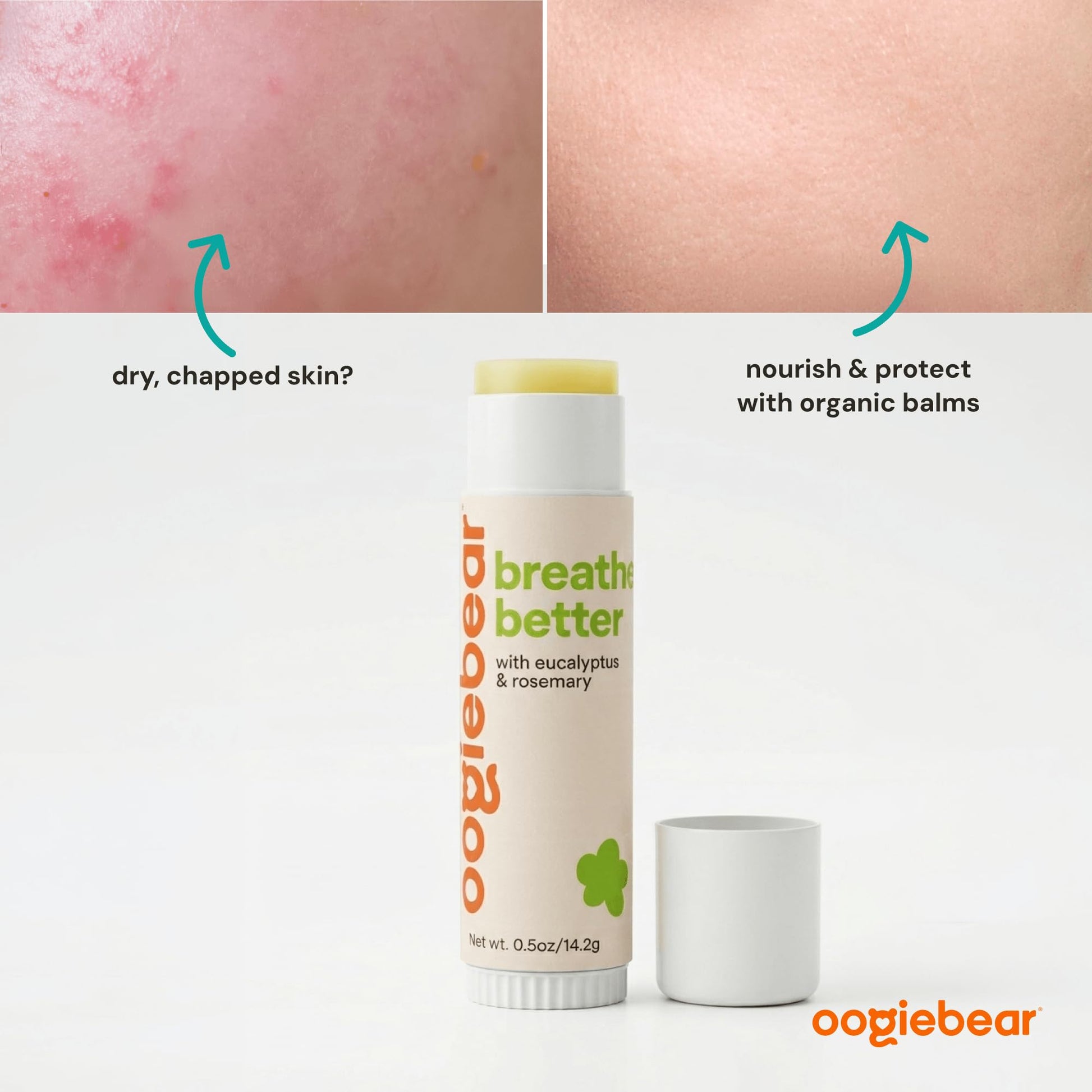 Natural cold pressed eucalyptus oil baby rub for easy breathing