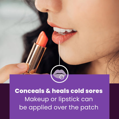 Close up of Mederma cold sore healing patch on skin
