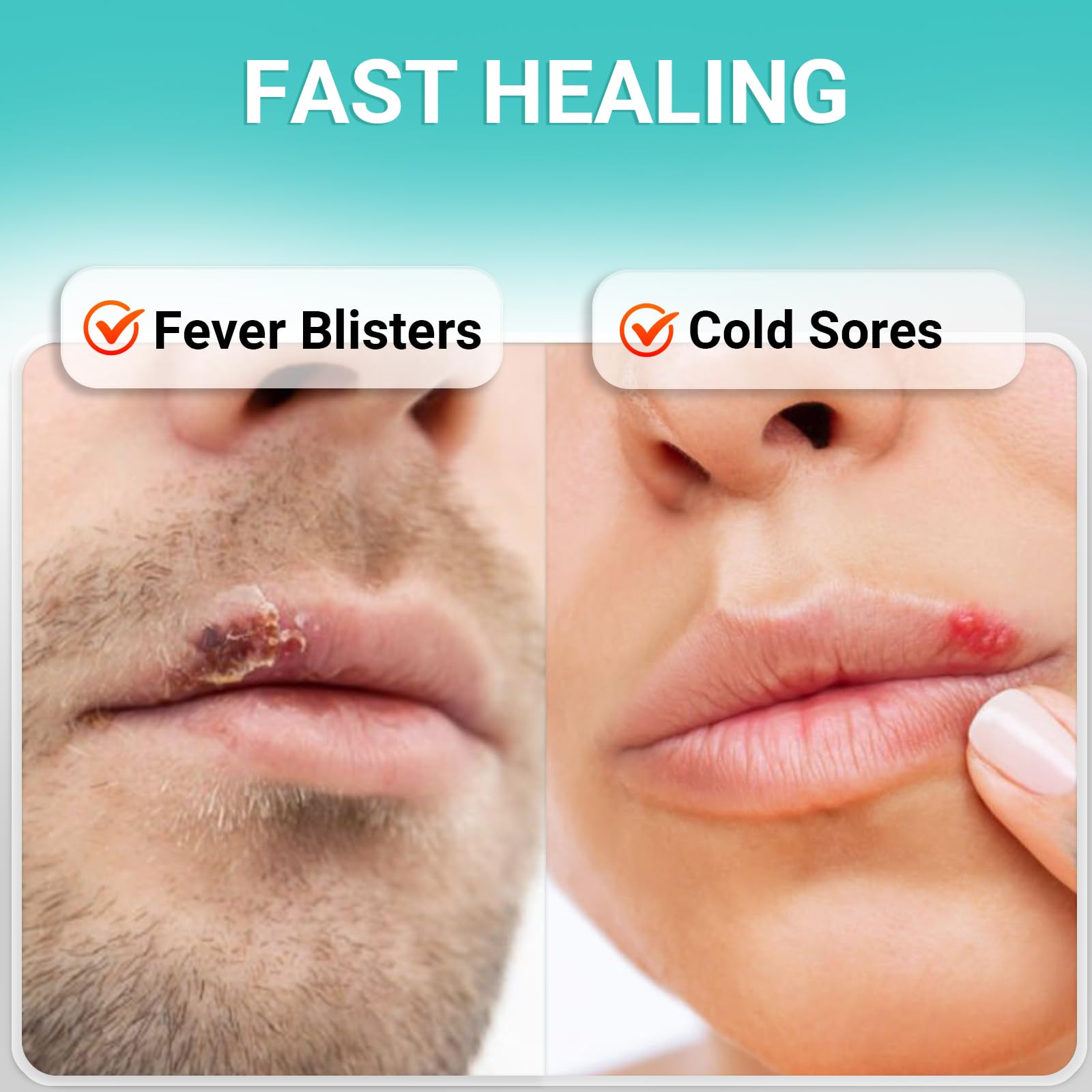 Ishancare lip herpes ointment portable 10g tube for fast relief