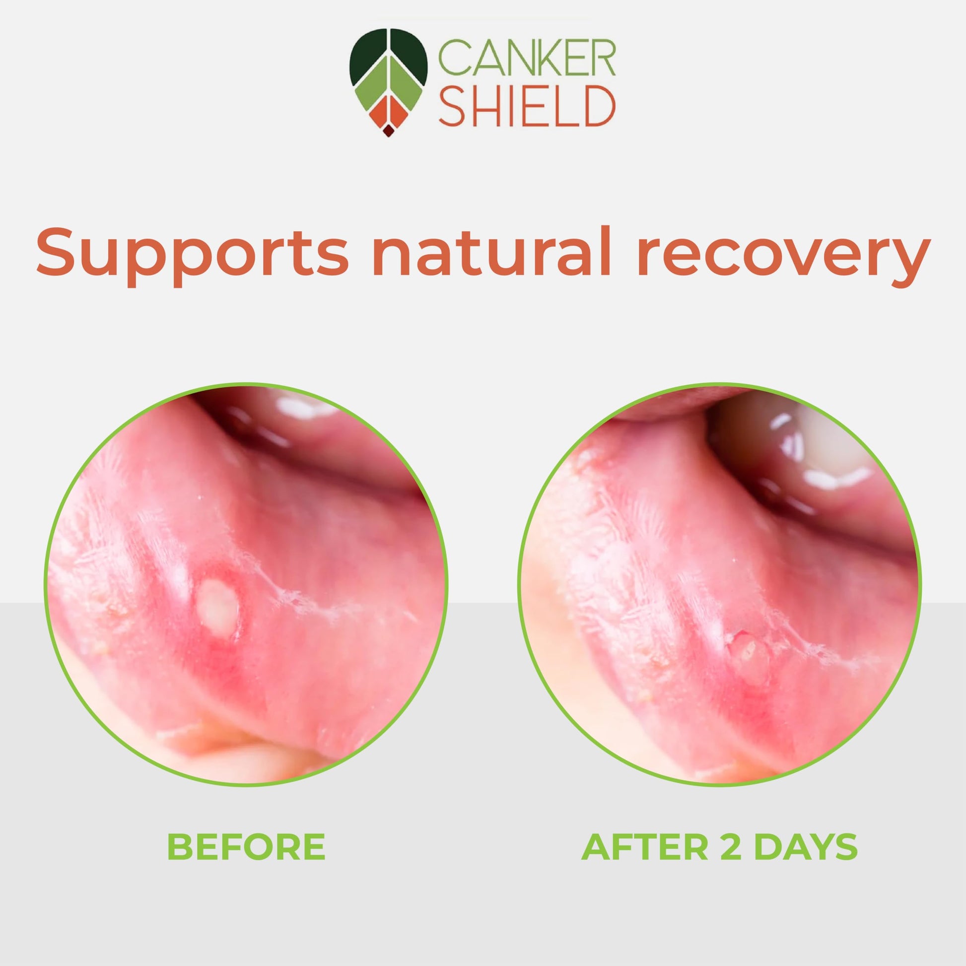 Close up shot of Canker Shield soothing oral powder label showing product details and size.