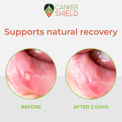 Close up shot of Canker Shield soothing oral powder label showing product details and size.