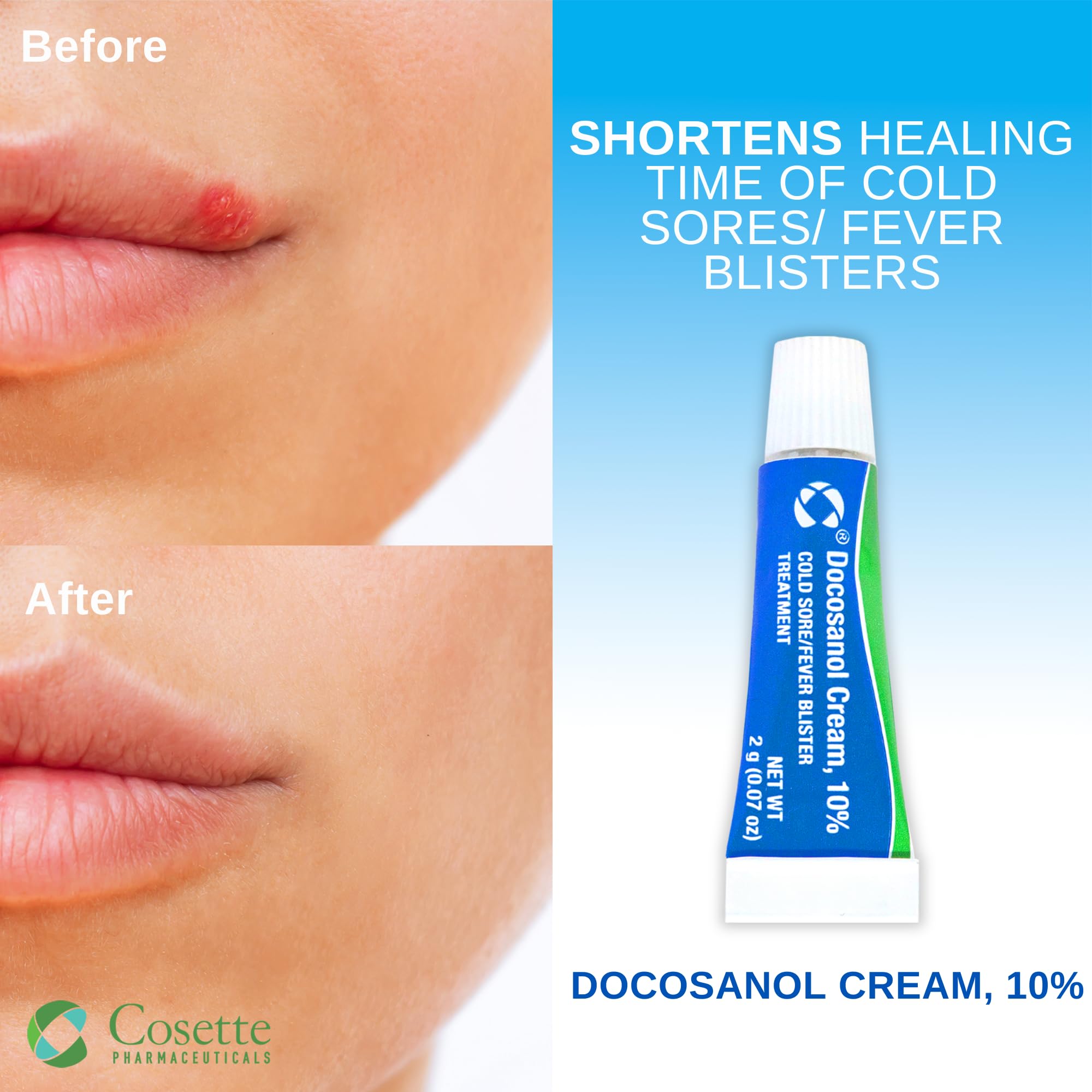 Cosette Fever Blister Treatment Tube showing zero point zero seven ounce sizing
