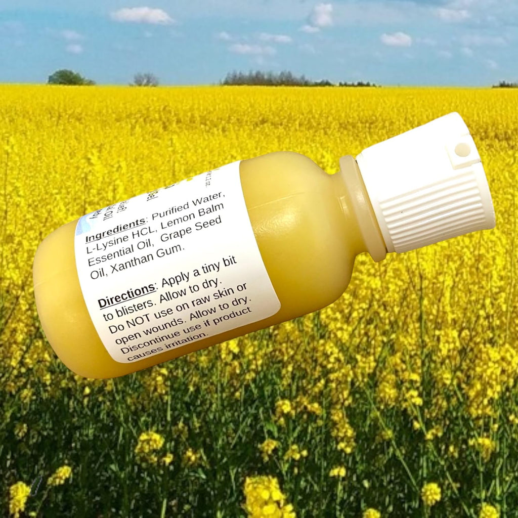 Authentic USA-imported Urban ReLeaf natural blister remedy bottle showcasing usage directions and product size.