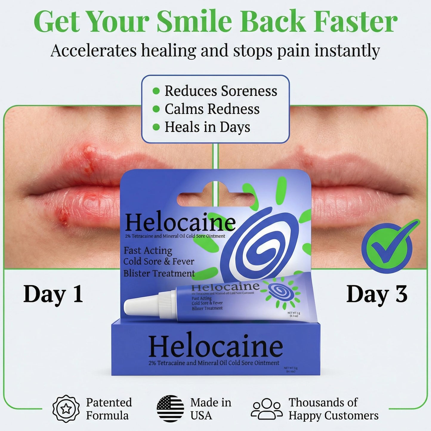 Authentic Helocaine rapid pain relief gel imported formula for mouth ulcers
