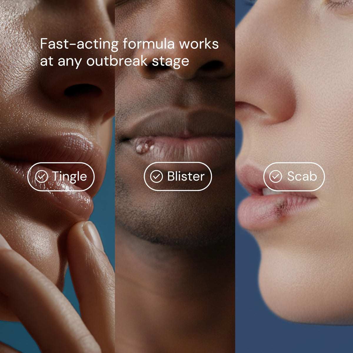 Herstat fast acting topical treatment formula for lips close up shot