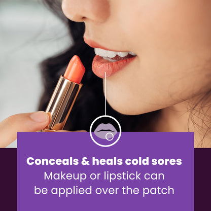 Close up of Mederma cold sore protective barrier patch concealing skin redness and swelling.
