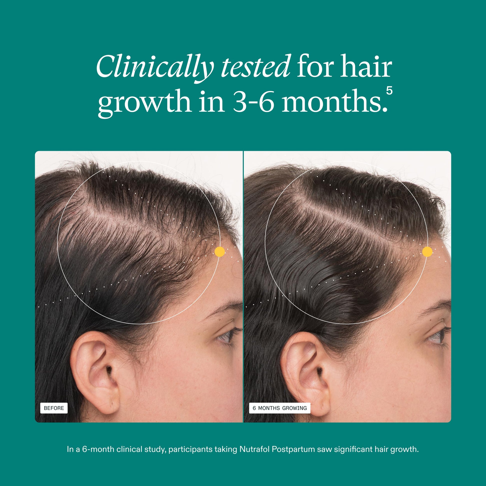 Nutrafol Postpartum hair shedding remedy bottle showcasing clean ingredient profile for lactation safety