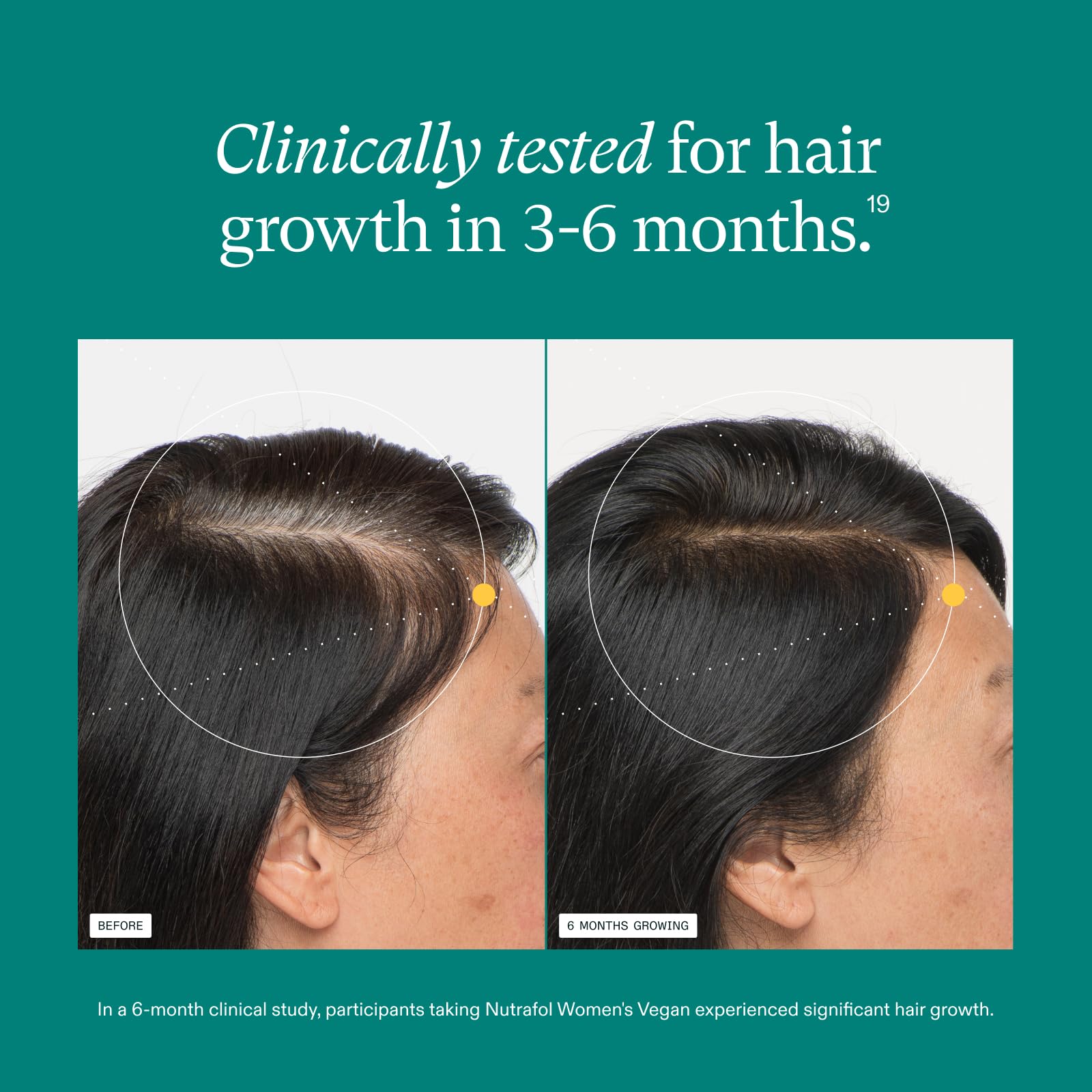 Dermatologist recommended hair growth vitamins for thinning relief