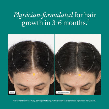 Nutrafol Synergen Complex hair wellness nutraceutical capsules for combating hair thinning