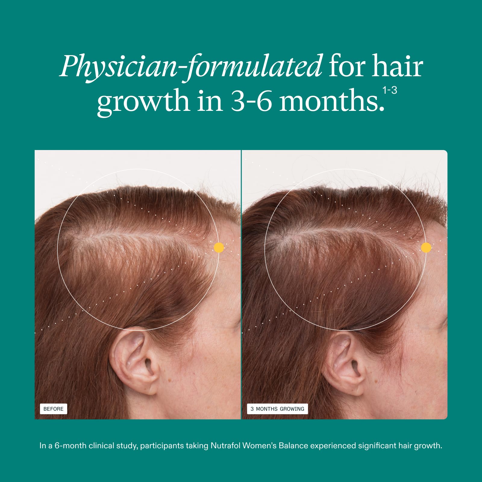 Dermatologist recommended Nutrafol hair wellness formula ingredient facts panel