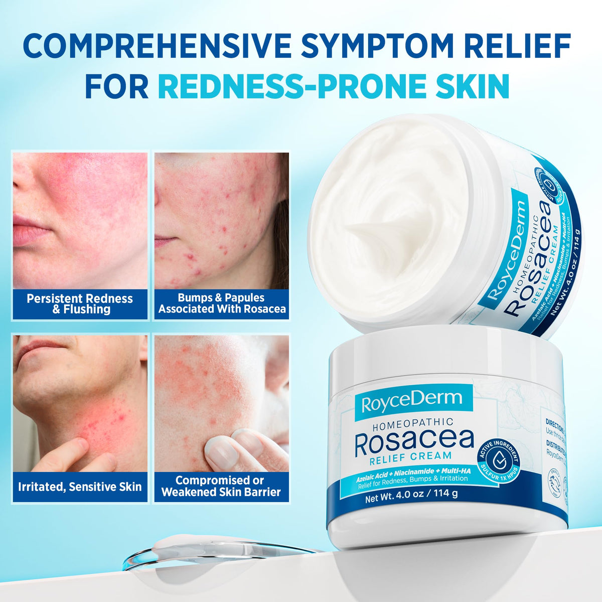 Open jar of Roycederm Homeopathic Rosacea Treatment showing texture of the non-steroid cream.