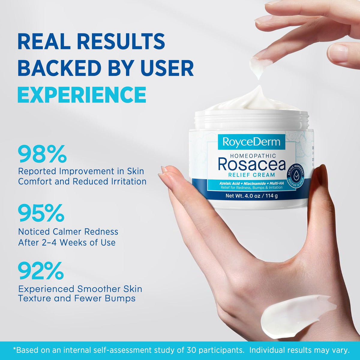 Roycederm Rosacea treatment product label outlining usage instructions for target skin bumps.