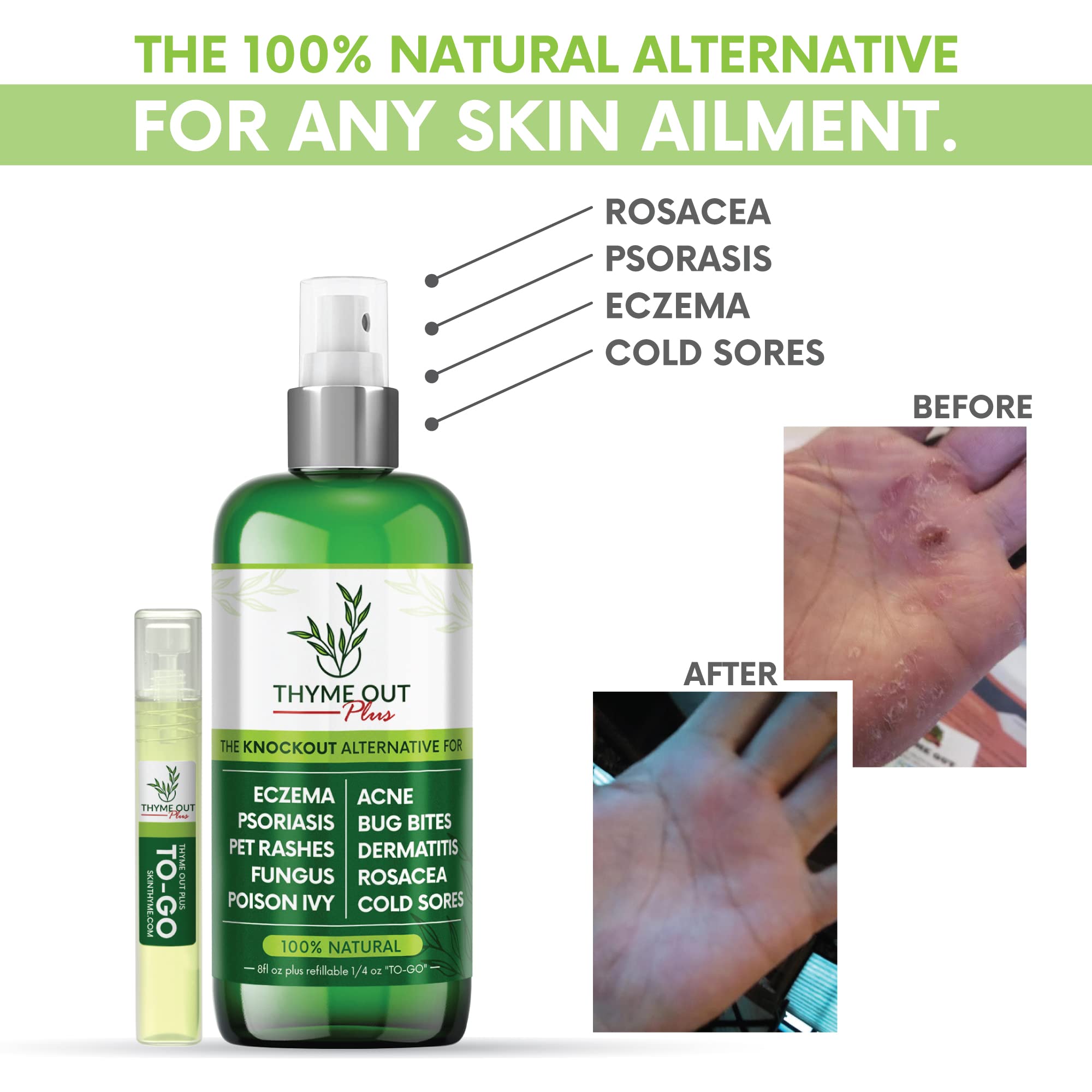Thyme Out Plus eight fluid ounce bottle with portable travel sprayer for natural skin relief