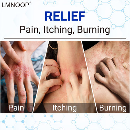 LMNOOP skin relief ointment tube showing the net weight of one point seven six ounces.
