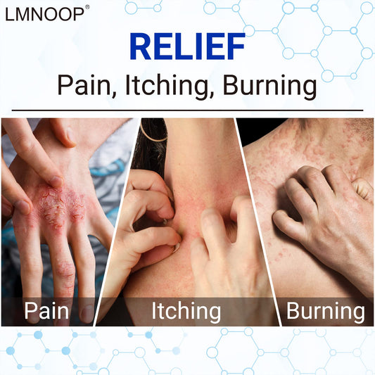 LMNOOP skin relief ointment tube showing the net weight of one point seven six ounces.