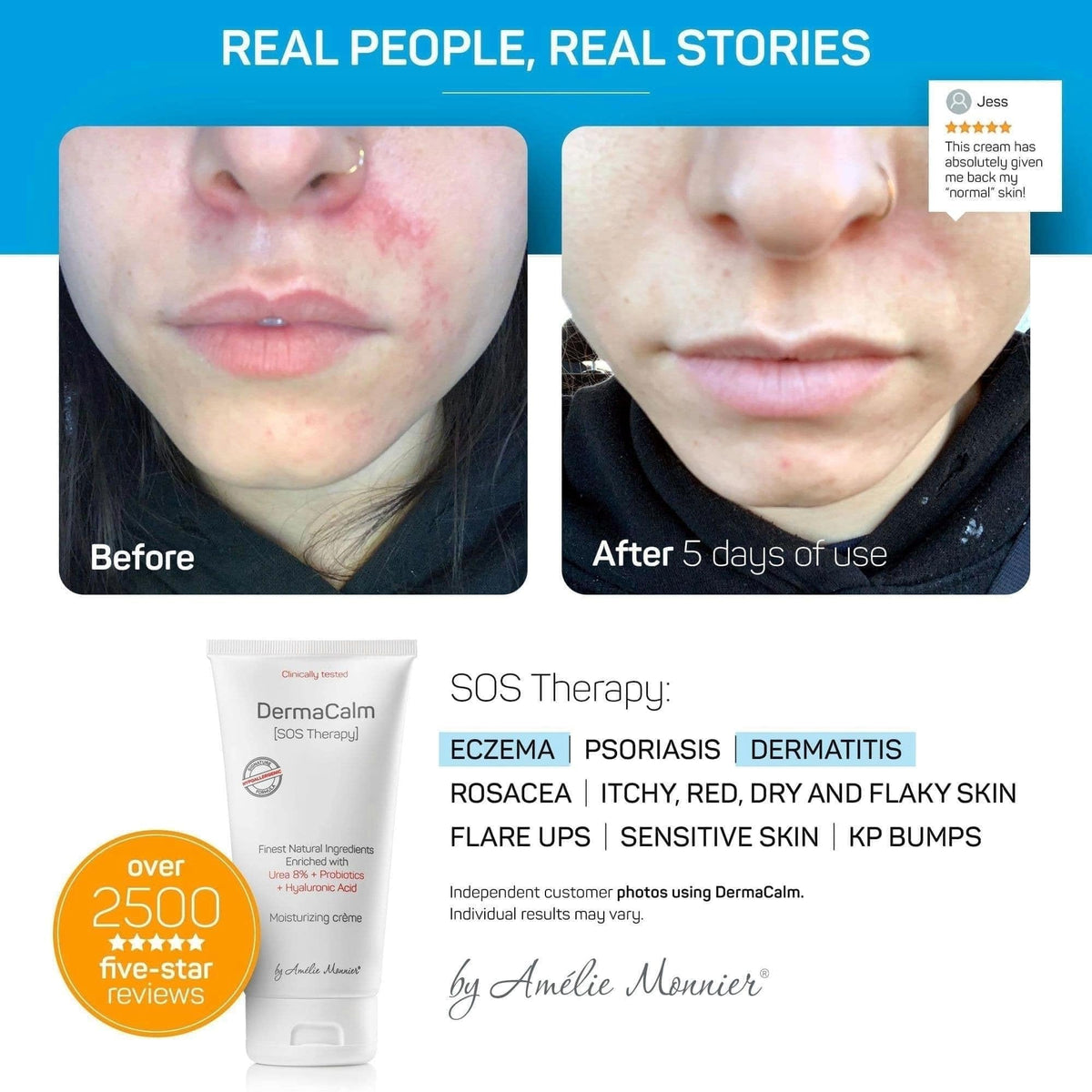AmÃ©lie Monnier DermaCalm face and body moisturizing cream for dry skin