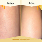 Gentle colloidal oatmeal and honey body wash by Eczema Honey brand for soothing itchy skin flares