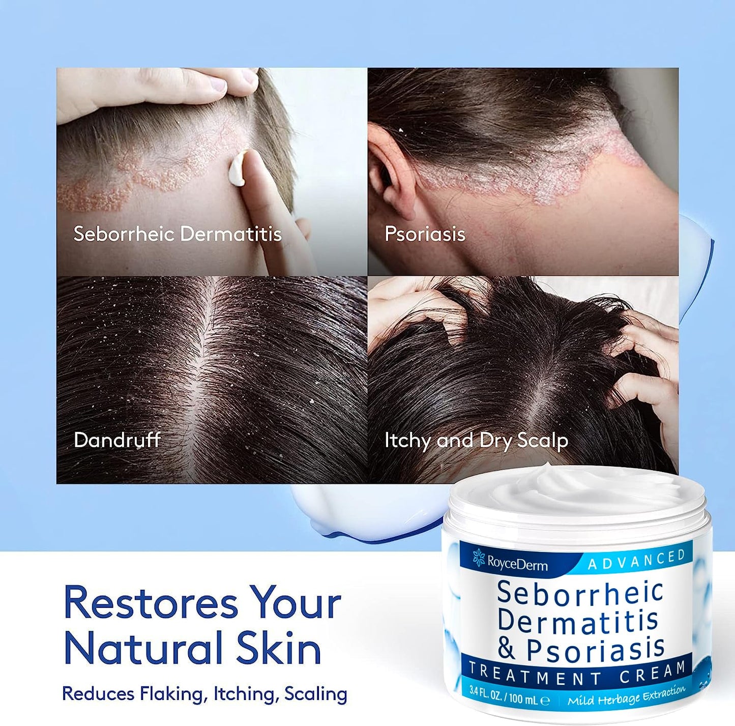 Roycederm steroid free dermatitis ointment texture demonstration on skin