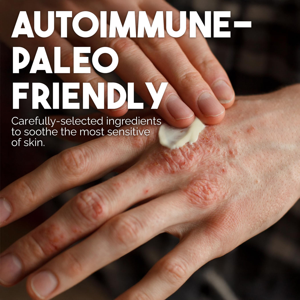 Texture and consistency of non-greasy Manuka honey ointment for dermatitis relief