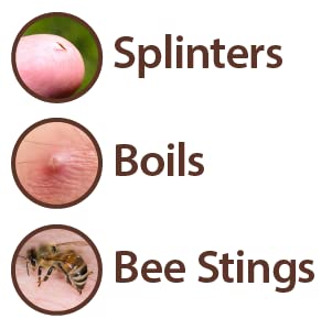 Globe pharmaceutical grade ichthammol tube for boil and splinter treatment