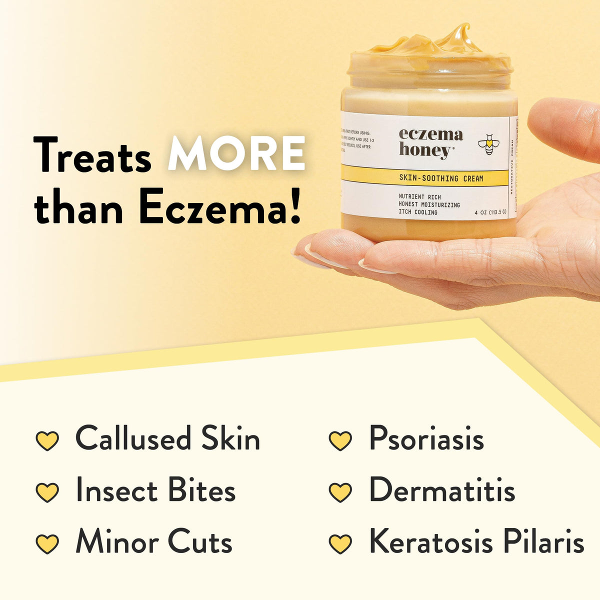 Eczema Honey dermatologist approved packaging back view showing directions for use