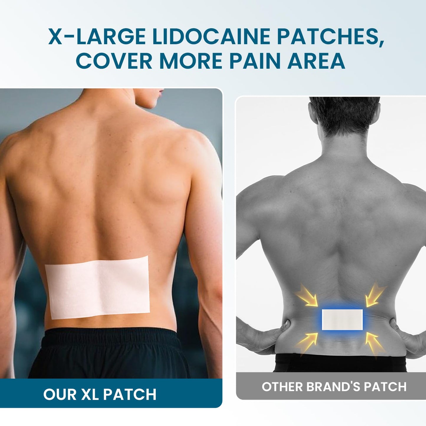 Application of Sumifun extra large pain relief patch on the lower back for sciatica