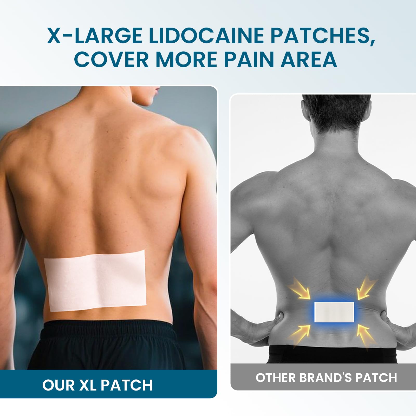 Application of Sumifun extra large pain relief patch on the lower back for sciatica